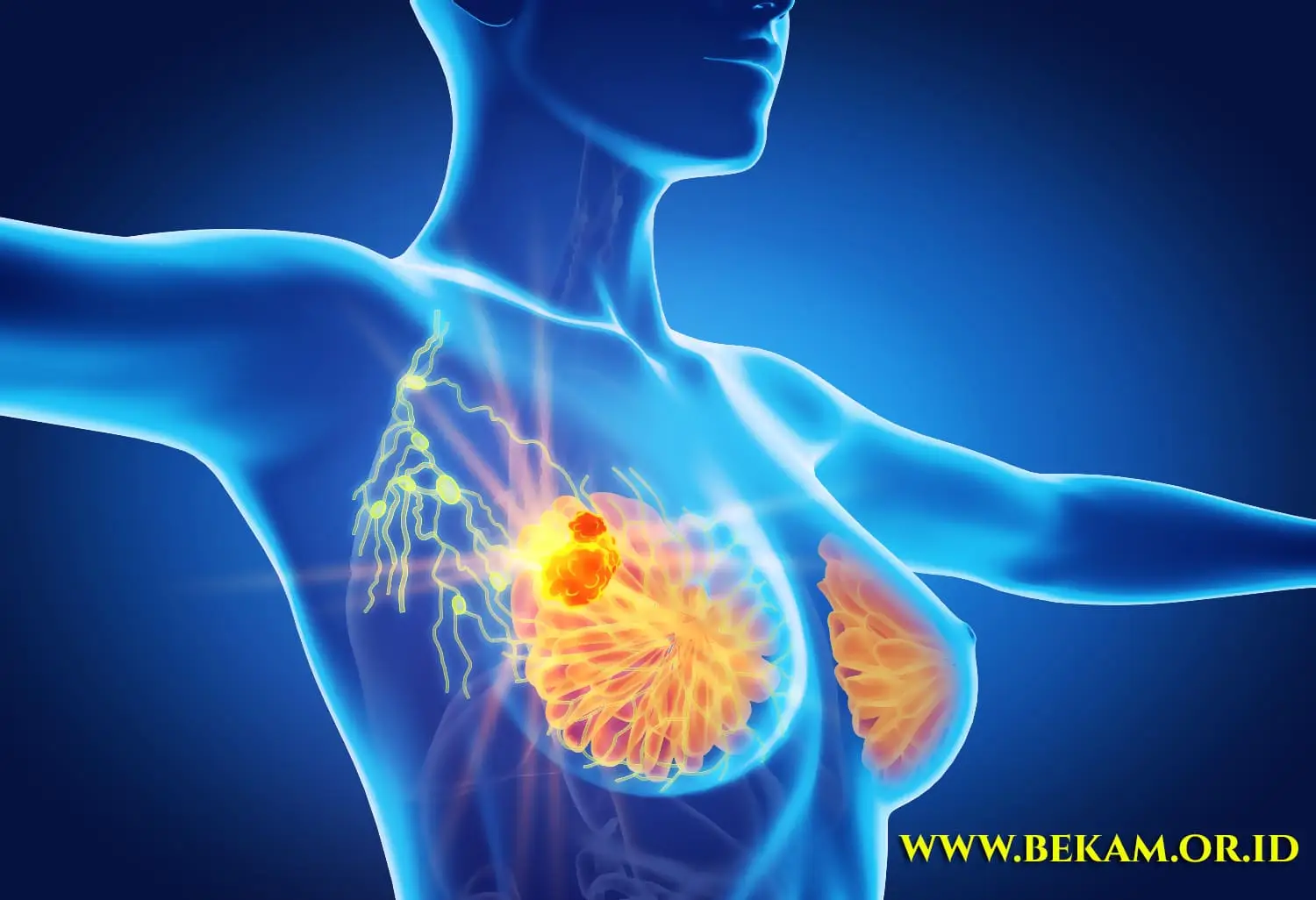 Bekam Redakan Nyeri Kanker Payudara Ini Penjelasan Ilmiahnya dan Bagaimana Mekanismenya Kerja Bekam